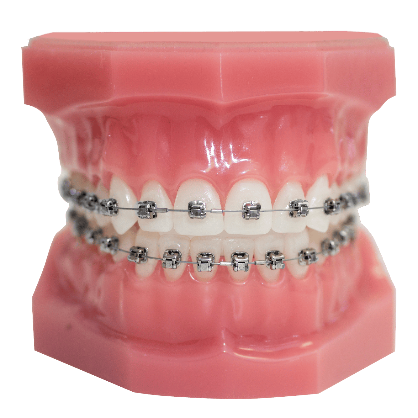 Braces Gainesville FL Next Level Orthodontics